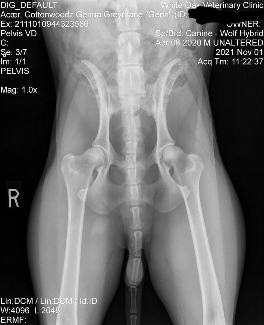 Genn Official Hip X-Ray