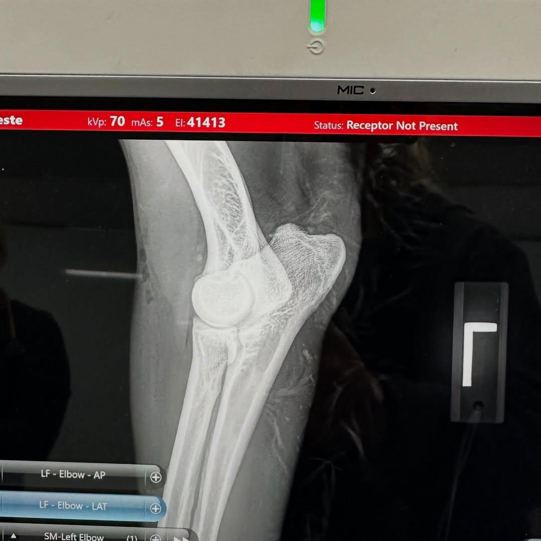 Milo Elbow X-Ray 3