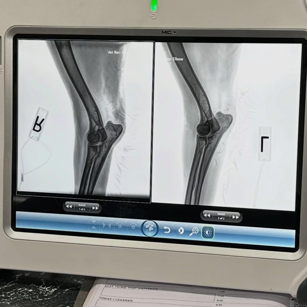 Milo Right and Left Elbow X-Ray